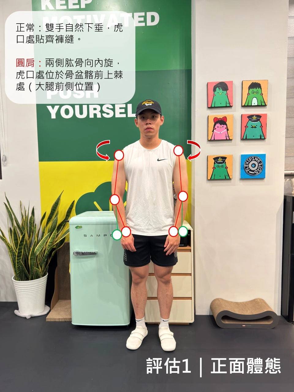 評估一｜正面體態與手掌位置觀察